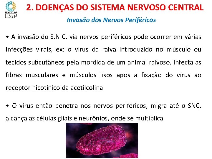 Ciências, 8º ano Sistema nervoso e as principais doenças 2. DOENÇAS DO SISTEMA NERVOSO