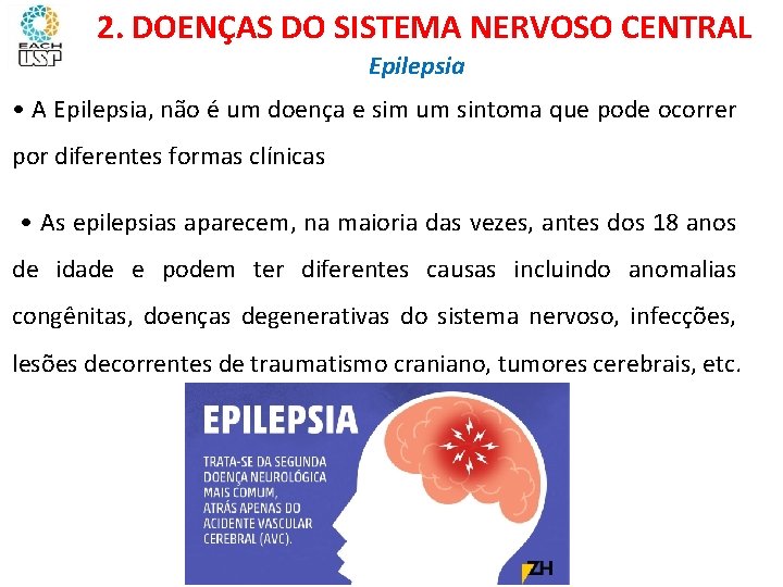 Ciências, 8º ano Sistema nervoso e as principais doenças 2. DOENÇAS DO SISTEMA NERVOSO