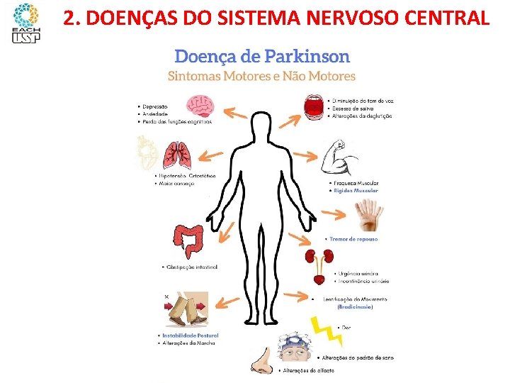 Ciências, 8º ano Sistema nervoso e as principais doenças 2. DOENÇAS DO SISTEMA NERVOSO