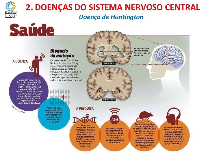 Ciências, 8º ano Sistema nervoso e as principais doenças 2. DOENÇAS DO SISTEMA NERVOSO