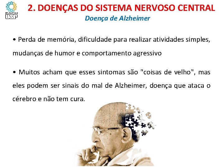 Ciências, 8º ano Sistema nervoso e as principais doenças 2. DOENÇAS DO SISTEMA NERVOSO