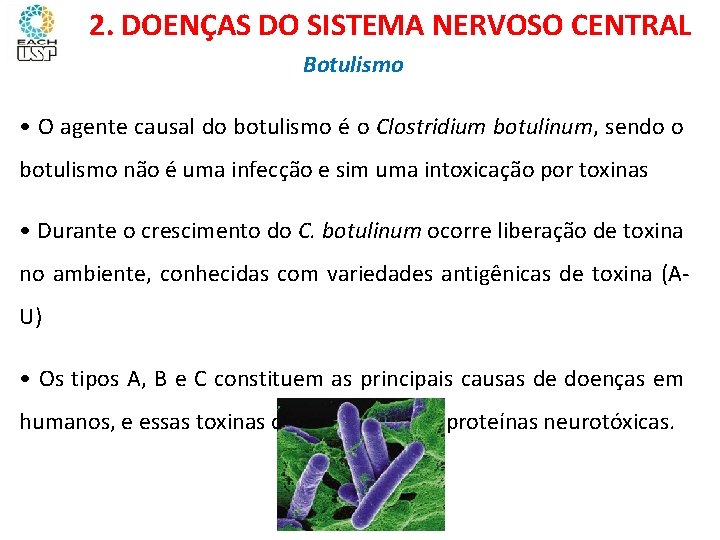 Ciências, 8º ano Sistema nervoso e as principais doenças 2. DOENÇAS DO SISTEMA NERVOSO