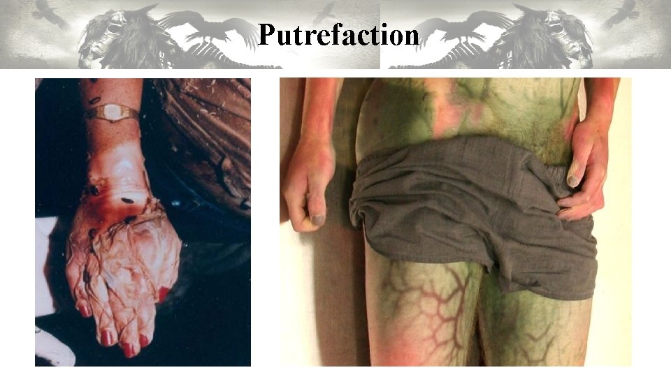 Putrefaction Putrefaction