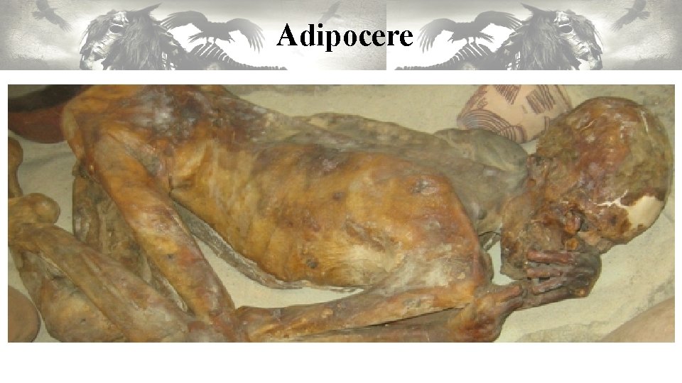 Adipocere Adipocere