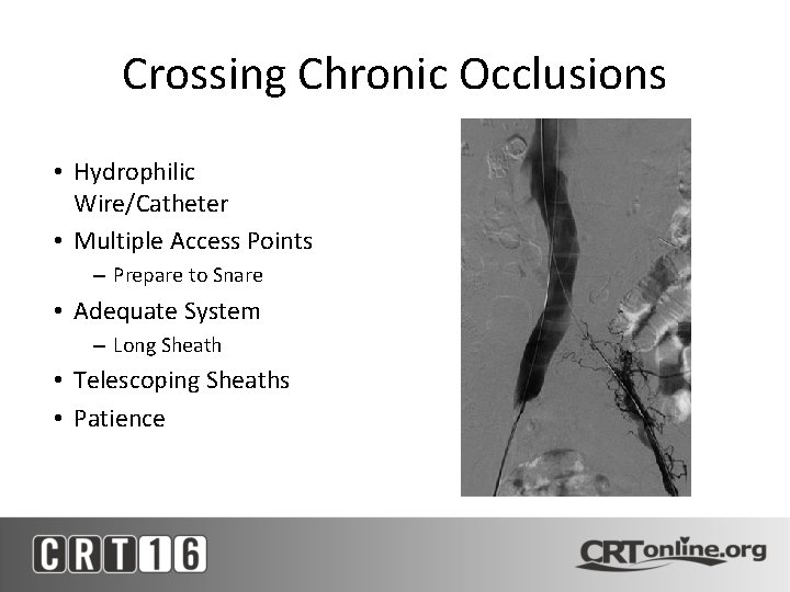 Crossing Chronic Occlusions • Hydrophilic Wire/Catheter • Multiple Access Points – Prepare to Snare