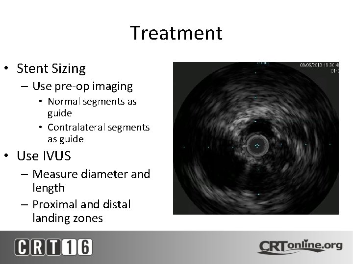 Treatment • Stent Sizing – Use pre-op imaging • Normal segments as guide •