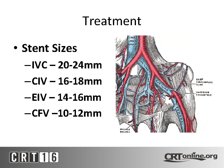 Treatment • Stent Sizes – IVC – 20 -24 mm – CIV – 16