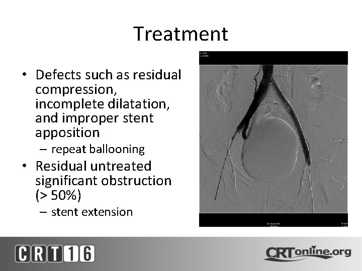 Treatment • Defects such as residual compression, incomplete dilatation, and improper stent apposition –