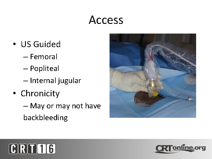 Access • US Guided – Femoral – Popliteal – Internal jugular • Chronicity –