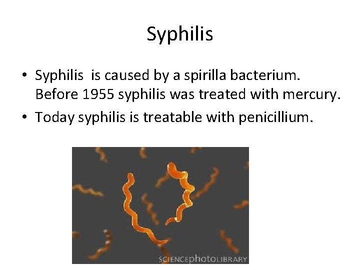 Syphilis • Syphilis is caused by a spirilla bacterium. Before 1955 syphilis was treated