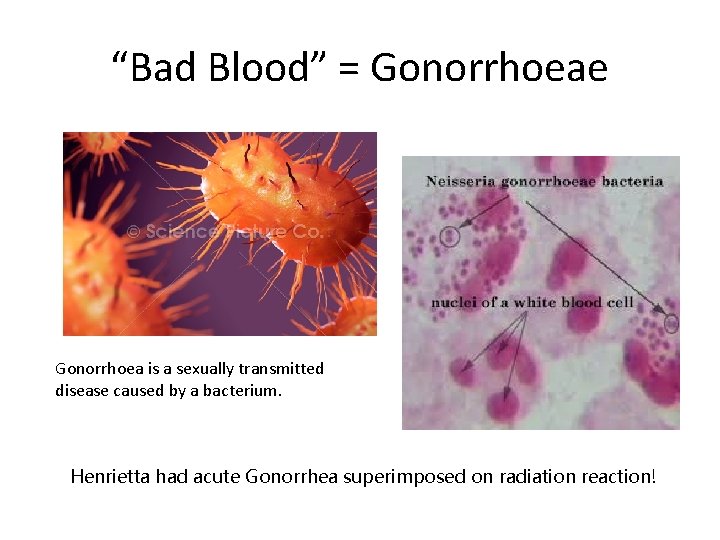 “Bad Blood” = Gonorrhoeae Gonorrhoea is a sexually transmitted disease caused by a bacterium.