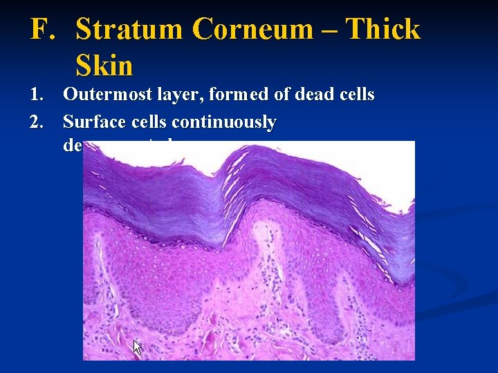 F. Stratum Corneum – Thick Skin 1. Outermost layer, formed of dead cells 2.
