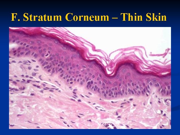 F. Stratum Corneum – Thin Skin 