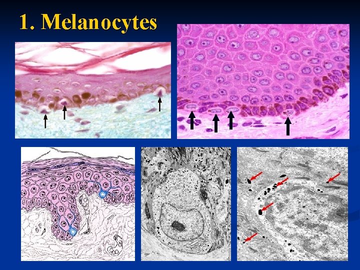 1. Melanocytes 