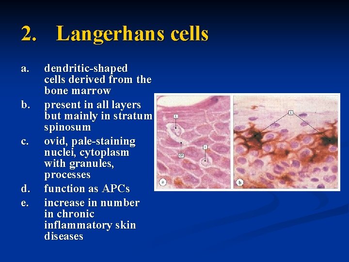2. Langerhans cells a. b. c. d. e. dendritic-shaped cells derived from the bone