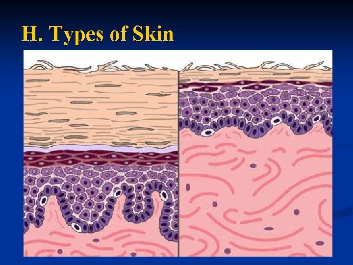 H. Types of Skin 
