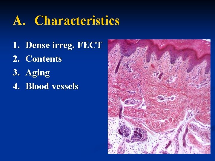 A. Characteristics 1. 2. 3. 4. Dense irreg. FECT Contents Aging Blood vessels 