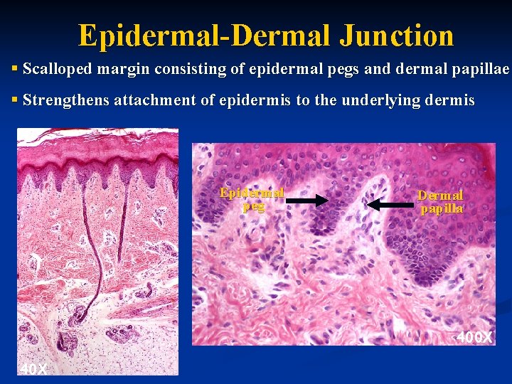 Epidermal-Dermal Junction § Scalloped margin consisting of epidermal pegs and dermal papillae § Strengthens