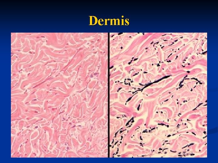 Dermis 