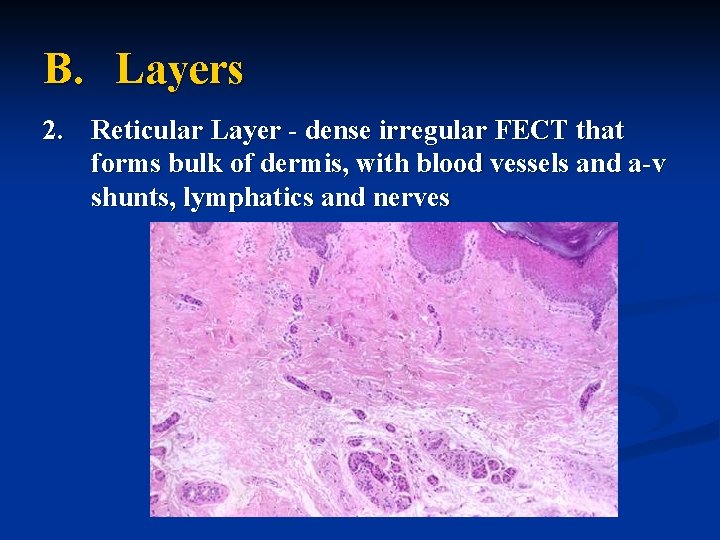 B. Layers 2. Reticular Layer - dense irregular FECT that forms bulk of dermis,