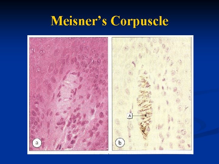 Meisner’s Corpuscle 