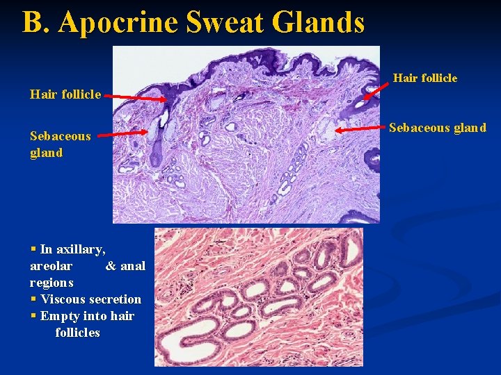 B. Apocrine Sweat Glands Hair follicle Sebaceous gland § In axillary, areolar & anal