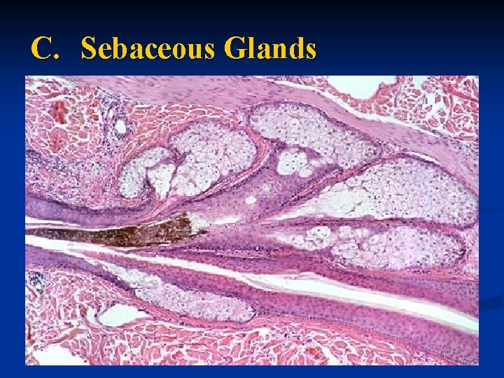 C. Sebaceous Glands 