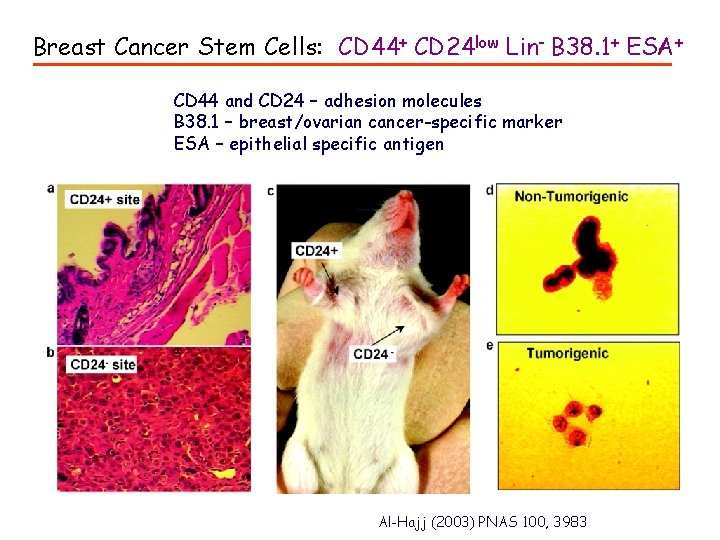 Breast Cancer Stem Cells: CD 44+ CD 24 low Lin- B 38. 1+ ESA+