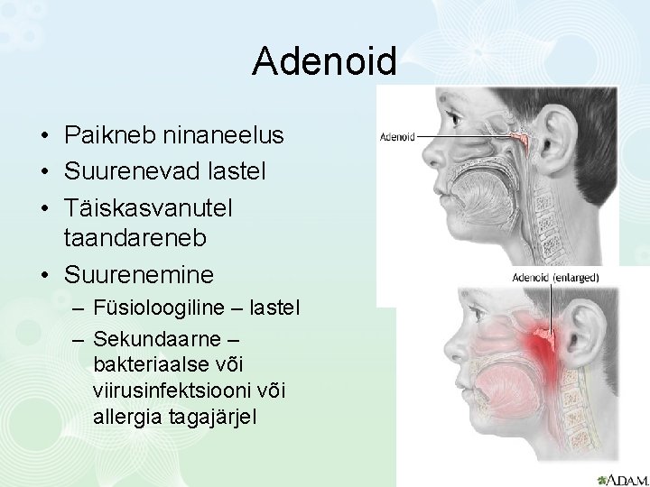Adenoid • Paikneb ninaneelus • Suurenevad lastel • Täiskasvanutel taandareneb • Suurenemine – Füsioloogiline