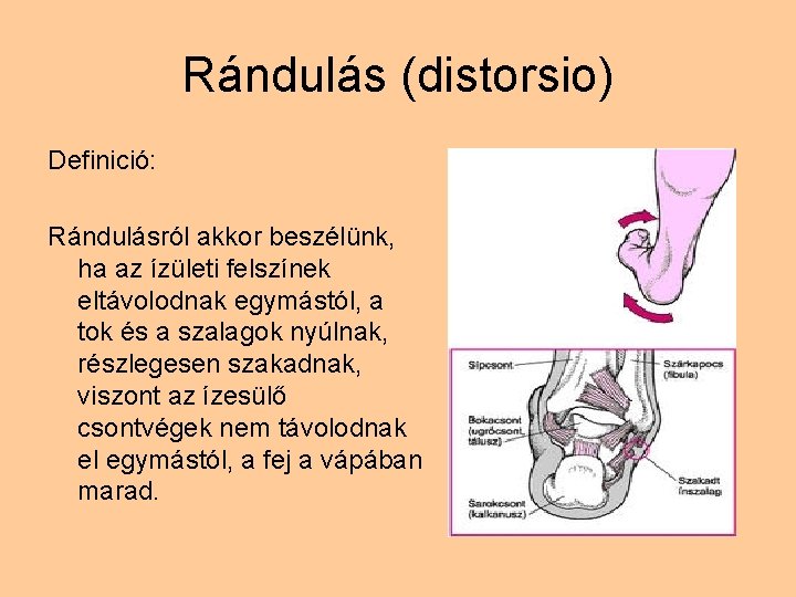 Rándulás (distorsio) Definició: Rándulásról akkor beszélünk, ha az ízületi felszínek eltávolodnak egymástól, a tok