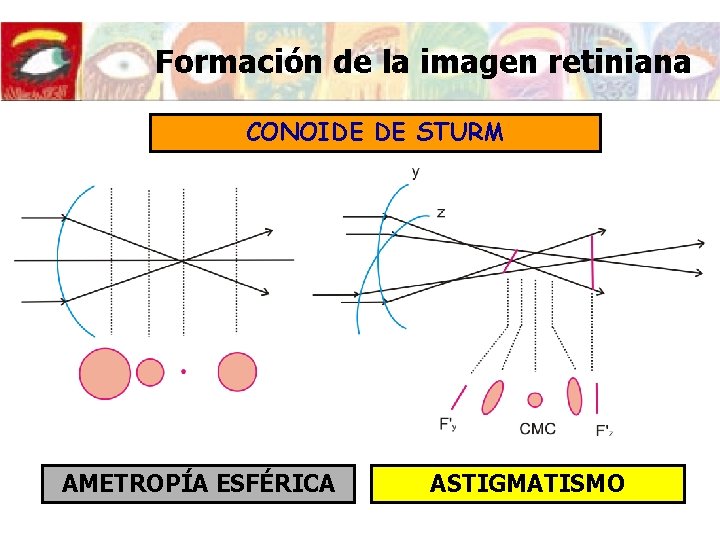 Formación de la imagen retiniana CONOIDE DE STURM AMETROPÍA ESFÉRICA ASTIGMATISMO Formación de la imagen retiniana CONOIDE DE STURM AMETROPÍA ESFÉRICA ASTIGMATISMO