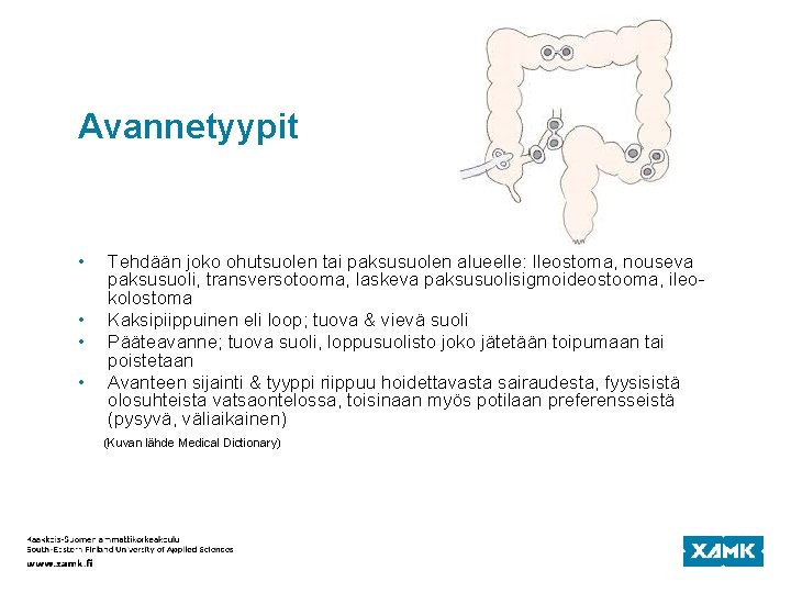 Avannetyypit • • Tehdään joko ohutsuolen tai paksusuolen alueelle: Ileostoma, nouseva paksusuoli, transversotooma, laskeva