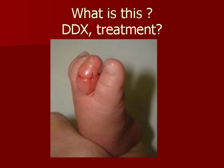 What is this ? DDX, treatment? What is this ? DDX, treatment?