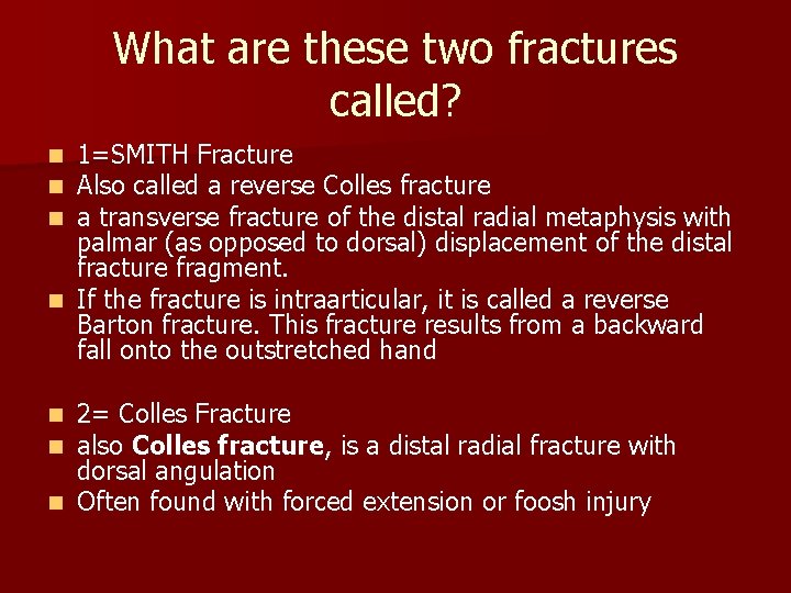 What are these two fractures called? 1=SMITH Fracture Also called a reverse Colles fracture What are these two fractures called? 1=SMITH Fracture Also called a reverse Colles fracture