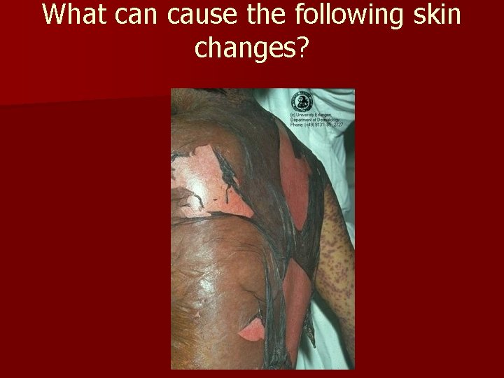 What can cause the following skin changes? What can cause the following skin changes?