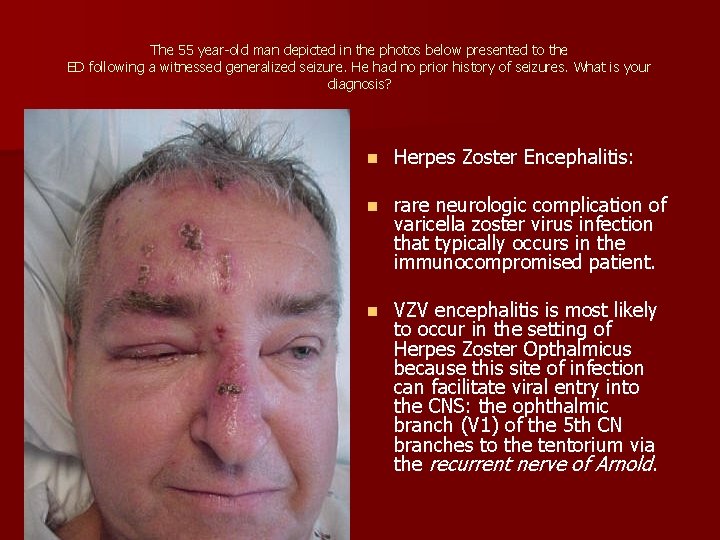 The 55 year-old man depicted in the photos below presented to the ED following The 55 year-old man depicted in the photos below presented to the ED following