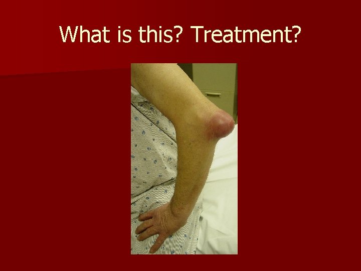 What is this? Treatment? What is this? Treatment?