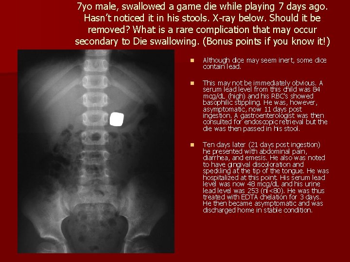 7 yo male, swallowed a game die while playing 7 days ago. Hasn’t noticed 7 yo male, swallowed a game die while playing 7 days ago. Hasn’t noticed