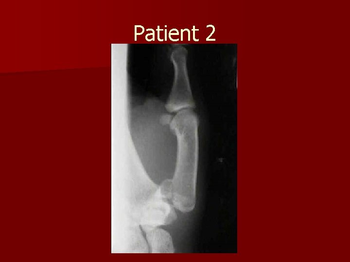 Patient 2 Patient 2