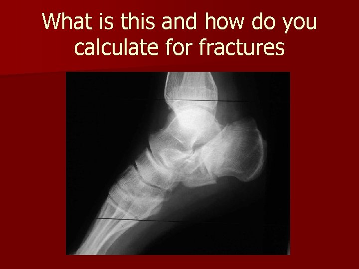 What is this and how do you calculate for fractures What is this and how do you calculate for fractures