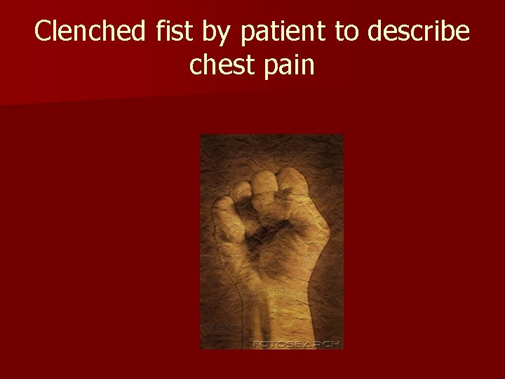 Clenched fist by patient to describe chest pain Clenched fist by patient to describe chest pain