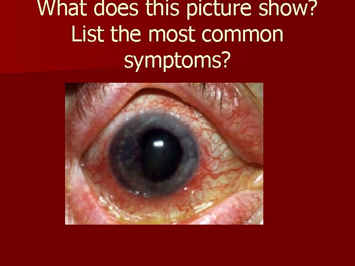 What does this picture show? List the most common symptoms? What does this picture show? List the most common symptoms?