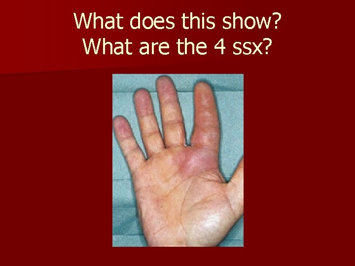 What does this show? What are the 4 ssx? What does this show? What are the 4 ssx?