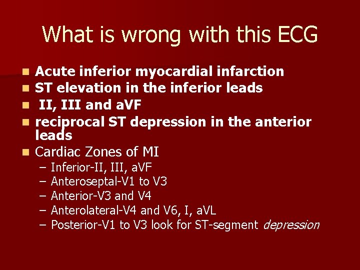What is wrong with this ECG Acute inferior myocardial infarction ST elevation in the What is wrong with this ECG Acute inferior myocardial infarction ST elevation in the