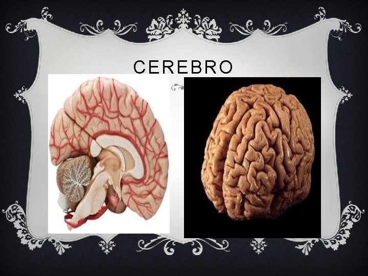 CEREBRO 