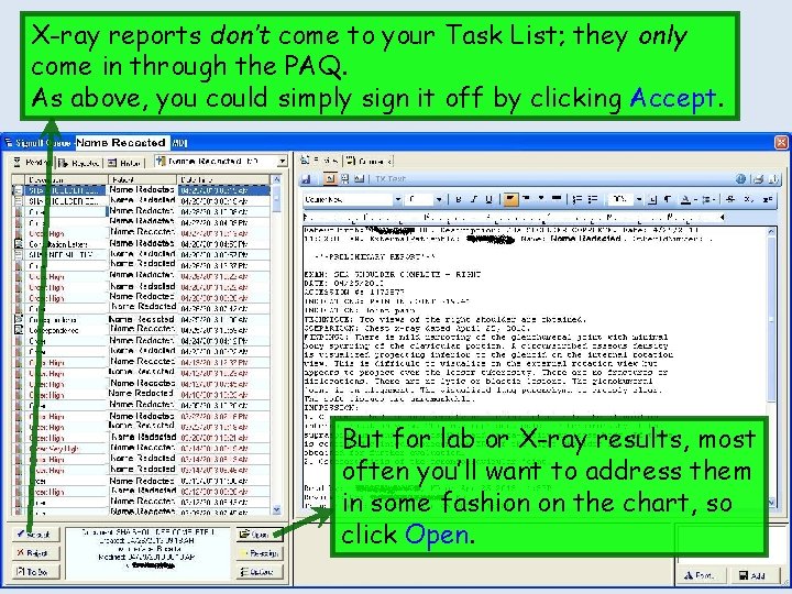 X-ray reports don’t come to your Task List; they only come in through the
