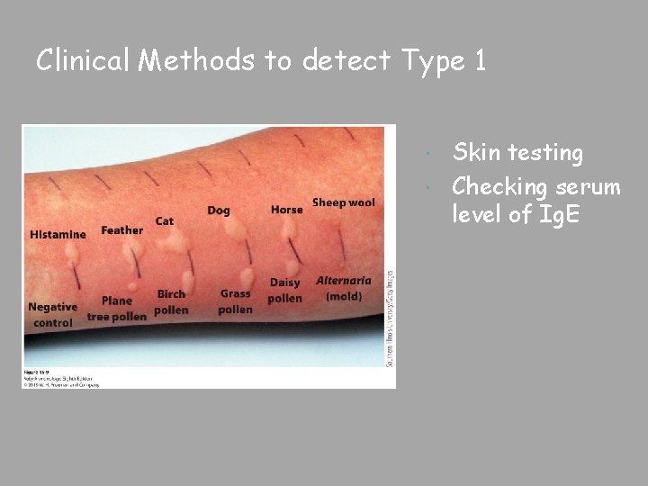 Clinical Methods to detect Type 1 Skin testing Checking serum level of Ig. E