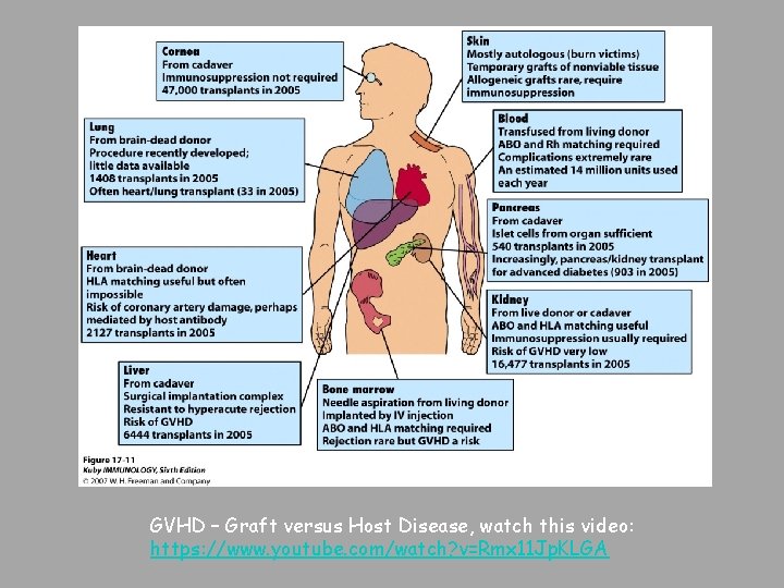 GVHD – Graft versus Host Disease, watch this video: https: //www. youtube. com/watch? v=Rmx