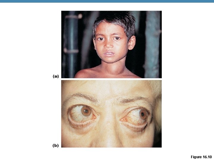 Figure 16. 10 Figure 16. 10