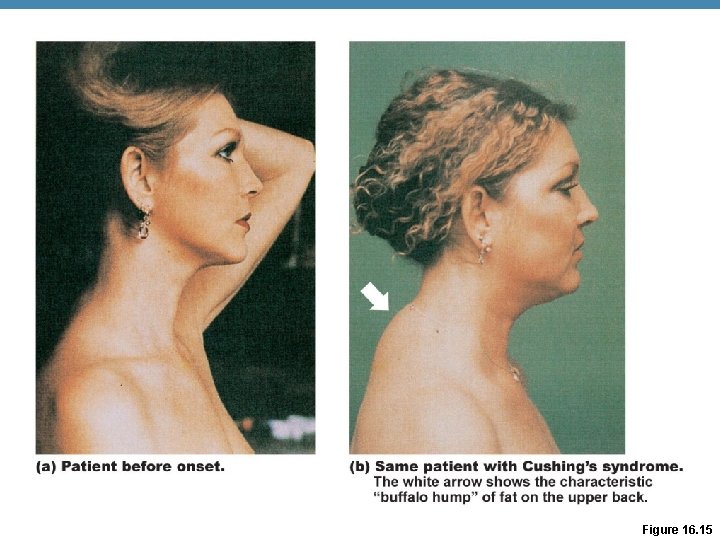 Figure 16. 15 Figure 16. 15